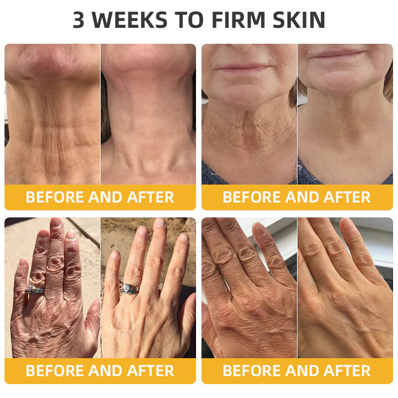[Official Brand Store]🐝Sabax® Bee Venom Retinol Skin Salve Ointment
