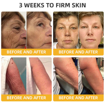 [Official Brand Store]🐝Sabax® Bee Venom Retinol Skin Salve Ointment